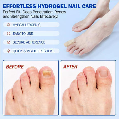 Nail Health Care Patches, Nail Fungus Care Patches, Suitable for Solving Fungal Nails and Other Nail Problems
