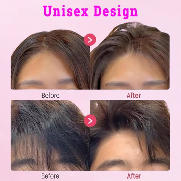 ✨ Juxek™ Root volumizing hair clip—Fluffy Hair in Seconds!